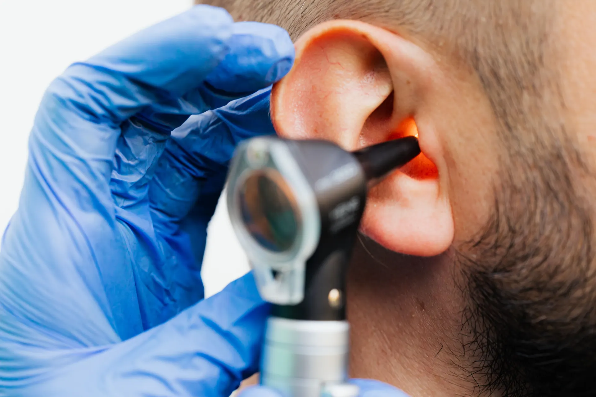 Sudden Hearing Loss (SSNHL)